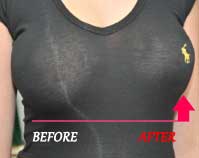 Out of shapes breasts