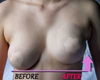Perks up your breasts